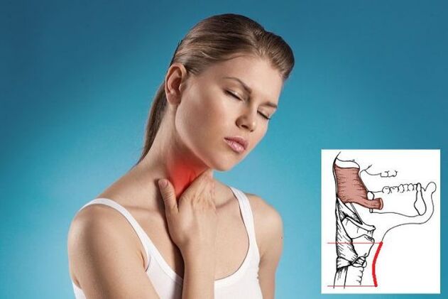 Halsschmerzen mit zervikaler Osteochondrose