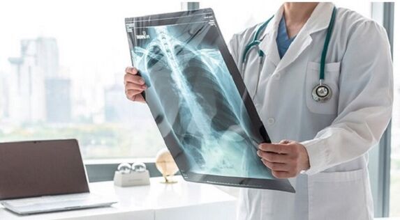 Röntgendiagnostik bei Schmerzen unter dem linken Schulterblatt.